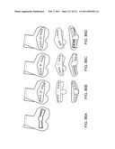 Patient-adapted and improved articular implants, designs and related guide tools diagram and image