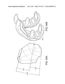 Patient-adapted and improved articular implants, designs and related guide tools diagram and image