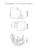 Patient-adapted and improved articular implants, designs and related guide tools diagram and image