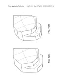 Patient-adapted and improved articular implants, designs and related guide tools diagram and image