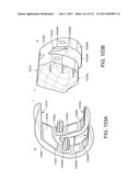 Patient-adapted and improved articular implants, designs and related guide tools diagram and image