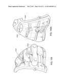 Patient-adapted and improved articular implants, designs and related guide tools diagram and image