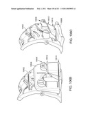 Patient-adapted and improved articular implants, designs and related guide tools diagram and image