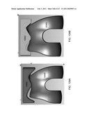 Patient-adapted and improved articular implants, designs and related guide tools diagram and image