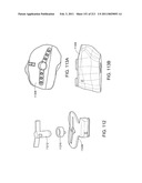 Patient-adapted and improved articular implants, designs and related guide tools diagram and image