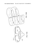 Patient-adapted and improved articular implants, designs and related guide tools diagram and image