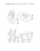 Patient-adapted and improved articular implants, designs and related guide tools diagram and image