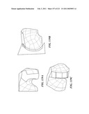 Patient-adapted and improved articular implants, designs and related guide tools diagram and image