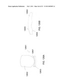 Patient-adapted and improved articular implants, designs and related guide tools diagram and image