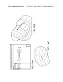 Patient-adapted and improved articular implants, designs and related guide tools diagram and image