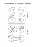 Patient-adapted and improved articular implants, designs and related guide tools diagram and image