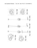 Patient-adapted and improved articular implants, designs and related guide tools diagram and image