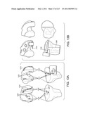 Patient-adapted and improved articular implants, designs and related guide tools diagram and image