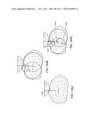 Patient-adapted and improved articular implants, designs and related guide tools diagram and image