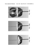 Patient-adapted and improved articular implants, designs and related guide tools diagram and image