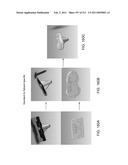 Patient-adapted and improved articular implants, designs and related guide tools diagram and image