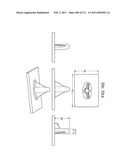 Patient-adapted and improved articular implants, designs and related guide tools diagram and image