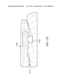 Patient-adapted and improved articular implants, designs and related guide tools diagram and image