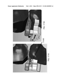 Patient-adapted and improved articular implants, designs and related guide tools diagram and image