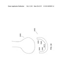 Patient-adapted and improved articular implants, designs and related guide tools diagram and image