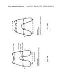 Patient-adapted and improved articular implants, designs and related guide tools diagram and image