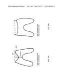 Patient-adapted and improved articular implants, designs and related guide tools diagram and image