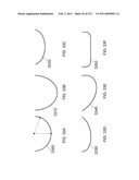 Patient-adapted and improved articular implants, designs and related guide tools diagram and image