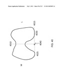 Patient-adapted and improved articular implants, designs and related guide tools diagram and image