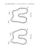 Patient-adapted and improved articular implants, designs and related guide tools diagram and image