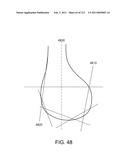 Patient-adapted and improved articular implants, designs and related guide tools diagram and image