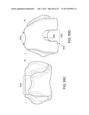 Patient-adapted and improved articular implants, designs and related guide tools diagram and image