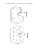 Patient-adapted and improved articular implants, designs and related guide tools diagram and image