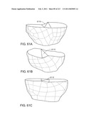 Patient-adapted and improved articular implants, designs and related guide tools diagram and image