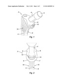 HIP PROSTHESIS diagram and image