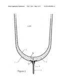 PROSTHETIC LINER WITH PERSPIRATION ELIMINATION MECHANISM diagram and image