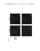 DIAGNOSIS AND TREATMENT OF AUTISM USING CD38 diagram and image