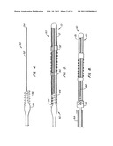 CONTRACEPTIVE TRANSCERVICAL FALLOPIAN TUBE OCCLUSION DEVICES AND METHODS diagram and image