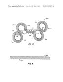 CONTRACEPTIVE TRANSCERVICAL FALLOPIAN TUBE OCCLUSION DEVICES AND METHODS diagram and image