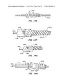 CONTRACEPTIVE TRANSCERVICAL FALLOPIAN TUBE OCCLUSION DEVICES AND METHODS diagram and image