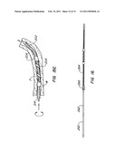 CONTRACEPTIVE TRANSCERVICAL FALLOPIAN TUBE OCCLUSION DEVICES AND METHODS diagram and image