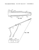 CONTRACEPTIVE TRANSCERVICAL FALLOPIAN TUBE OCCLUSION DEVICES AND METHODS diagram and image