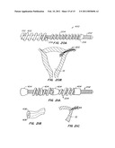 CONTRACEPTIVE TRANSCERVICAL FALLOPIAN TUBE OCCLUSION DEVICES AND METHODS diagram and image