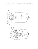 DUAL VOLUME AIR BAG diagram and image