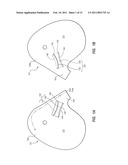 SAFETY VENTING WITH PASSIVELY CLOSEABLE VENTS diagram and image