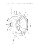 SAFETY VENTING WITH PASSIVELY CLOSEABLE VENTS diagram and image