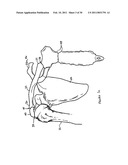 INTER-SCAPULAR BOLSTER diagram and image