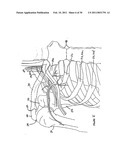 INTER-SCAPULAR BOLSTER diagram and image