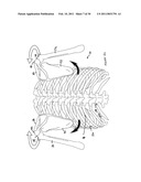 INTER-SCAPULAR BOLSTER diagram and image