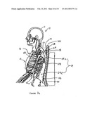 INTER-SCAPULAR BOLSTER diagram and image