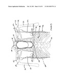 INTER-SCAPULAR BOLSTER diagram and image